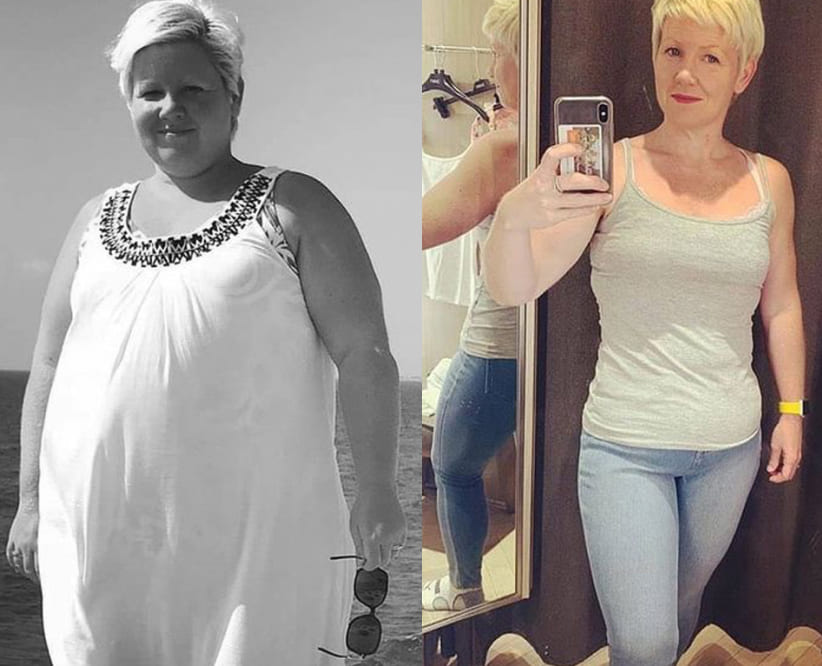 Before and after photos of a woman showing weight loss results.